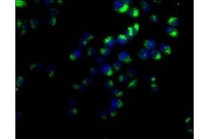 Immunofluorescence staining of Hela cells with ABIN7147175 at 1:50, counter-stained with DAPI. (CD63 Antikörper  (AA 103-203))