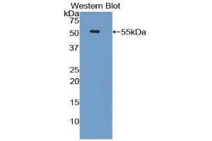 Western Blotting (WB) image for anti-Lipopolysaccharide Binding Protein (LBP) (AA 25-481) antibody (ABIN1859619)