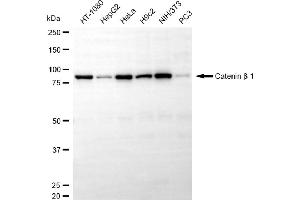 Western blotting analysis using catenin beta 1 antibody (ABIN7797926).