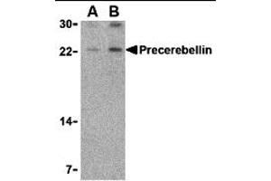 Western Blotting (WB) image for anti-Cerebellin 1 Precursor (CBLN1) (Middle Region) antibody (ABIN1031046) (CBLN1 Antikörper  (Middle Region))
