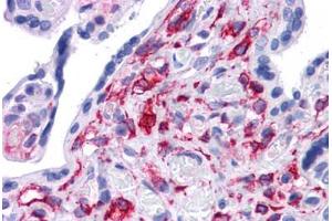 Human Placenta: Formalin-Fixed, Paraffin-Embedded (FFPE) (STAT5B Antikörper  (AA 180-229))