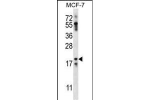 NRN1L Antibody (Center) (ABIN656859 and ABIN2846064) western blot analysis in MCF-7 cell line lysates (35 μg/lane).