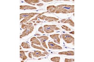 (ABIN6242395 and ABIN6577138) staining MKRN2 in human heart tissue sections by Immunohistochemistry (IHC-P - paraformaldehyde-fixed, paraffin-embedded sections). (MKRN2 Antikörper)