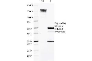 SDS-PAGE Analysis Purified CD50 Mouse Monoclonal Antibody (CG106). (ICAM-3/CD50 Antikörper)