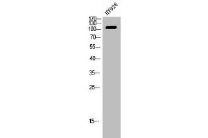 Western Blot analysis of HY926 cells using EphB4 Polyclonal Antibody (EPH Receptor B4 Antikörper  (Internal Region))