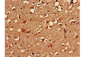 Immunohistochemistry of paraffin-embedded human brain tissue using ABIN7146602 at dilution of 1:100