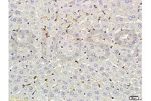 Immunohistochemistry (IHC) image for anti-Fc Fragment of IgG, Low Affinity IIb, Receptor (CD32) (FCGR2B) (pTyr292) antibody (ABIN761411)