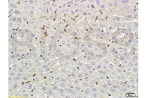 Formalin-fixed and paraffin embedded rat liver labeled with Rabbit Anti-phospho-CD32B(Tyr292) Polyclonal Antibody (ABIN761411) at 1:200 followed by conjugation to the secondary antibody and DAB staining. (FCGR2B Antikörper  (pTyr292))