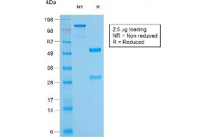 SDS-PAGE Analysis Purified CD79a Mouse Recombinant Monoclonal Antibody (rIGA/764). (Rekombinanter CD79a Antikörper)