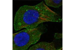 Confocal immunofluorescence analysis of A549 cells using DDR2 mouse mAb (green). (DDR2 Antikörper)