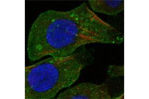 Confocal immunofluorescence analysis of A549 cells using DDR2 mouse mAb (green).