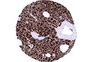 Pancreas (GP2 Antikörper  (AA 35-179))