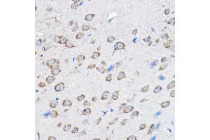 Immunohistochemistry of paraffin-embedded mouse brain using PTPN23 Rabbit pAb (ABIN1682396, ABIN3019081, ABIN3019082 and ABIN6220704) at dilution of 1:100 (40x lens).