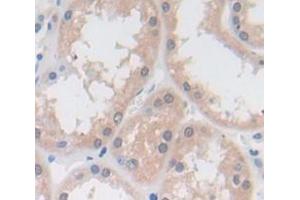 IHC-P analysis of Human Tissue, with DAB staining. (Vitamin D-Binding Protein Antikörper  (AA 18-211))