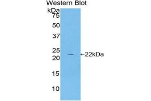 Western Blotting (WB) image for anti-Cyclin-Dependent Kinase Inhibitor 1A (p21, Cip1) (CDKN1A) (AA 1-164) antibody (ABIN1858350)