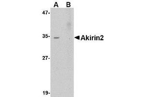 Western blot analysis of Akirin2 in Human Brain tissue lysate with AP30041PU-N Akirin2 antibody at 0. (AKIRIN2 Antikörper  (Center))