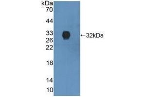 Detection of Recombinant ANXA6, Human using Polyclonal Antibody to Annexin A6 (ANXA6) (ANXA6 Antikörper  (AA 2-251))