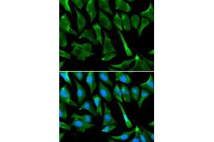 Immunofluorescence analysis of A549 cells using BRCA1 antibody. (BRCA1 Antikörper  (AA 120-220))