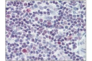 Immunohistochemistry (Paraffin-embedded Sections) (IHC (p)) image for anti-Baculoviral IAP Repeat-Containing 5 (BIRC5) antibody (ABIN1449649)