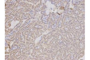 Immunohistochemistry (IHC) image for anti-Thymopoietin (TMPO) antibody (ABIN1875122) (Thymopoietin Antikörper)
