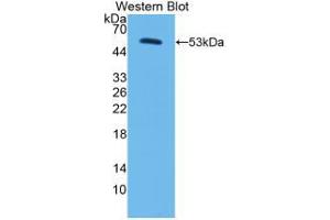 Western blot analysis of the recombinant protein. (Corin Antikörper  (AA 134-573))