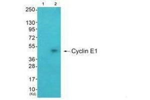 Western blot analysis of extracts from A549 cells (Lane 2), using Cyclin E1 antiobdy. (Cyclin E1 Antikörper)