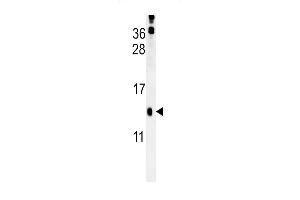 HRASLS3 Antibody (C-term) (ABIN651933 and ABIN2840461) western blot analysis in mouse kidney tissue lysates (15 μg/lane). (PLA2G16 Antikörper  (C-Term))