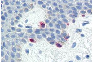 Human Skin, Melanocytes (formalin-fixed, paraffin-embedded) stained with MLANA antibody ABIN573958 at 10 ug/ml followed by biotinylated goat anti-rabbit IgG secondary antibody ABIN481713, alkaline phosphatase-streptavidin and chromogen. (MLANA Antikörper  (C-Term))