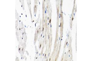 Immunohistochemistry of paraffin-embedded rat heart using SNRPF Rabbit pAb (ABIN6132678, ABIN6148228, ABIN6148229 and ABIN6215753) at dilution of 1:200 (40x lens). (SNRPF Antikörper  (AA 1-86))