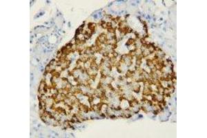 Image no. 1 for anti-Fatty Acid Binding Protein 1, Liver (FABP1) (N-Term) antibody (ABIN1495134) (FABP1 Antikörper  (N-Term))