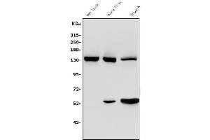 Western blot analysis of Ceruloplasmin/CP using anti-Ceruloplasmin/CP antibody (ABIN3044508). (Ceruloplasmin Antikörper  (AA 20-258))