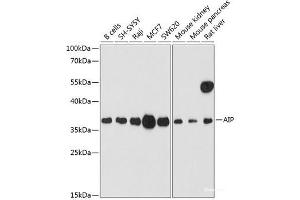 Western blot analysis of extracts of various cell lines using AIP Polyclonal Antibody at dilution of 1:1000. (AIP Antikörper)