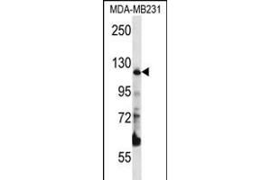 PITRM1 Antibody (Center) (ABIN656324 and ABIN2845623) western blot analysis in MDA-M cell line lysates (35 μg/lane). (PITRM1 Antikörper  (AA 490-518))