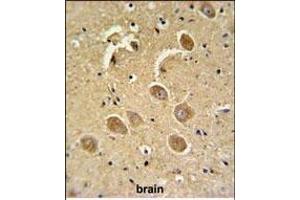 Immunohistochemistry (Paraffin-embedded Sections) (IHC (p)) image for anti-Caspase 3 (CASP3) (AA 149-179), (Asp175) antibody (ABIN651176)