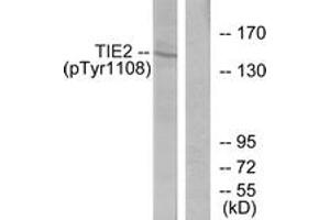 Western blot analysis of extracts from NIH-3T3 cells, using TIE2 (Phospho-Tyr1108) Antibody. (TEK Antikörper  (pTyr1108))