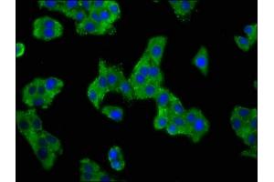 Immunofluorescence staining of HepG2 cells with ABIN7143000 at 1:100, counter-stained with DAPI. (ACCN1 Antikörper  (AA 197-345))