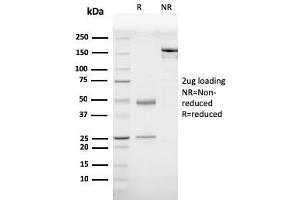 SDS-PAGE (SDS) image for anti-Prohibitin (PHB) (AA 167-261) antibody (ABIN6940300)