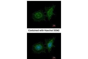 ICC/IF Image Immunofluorescence analysis of methanol-fixed HeLa, using SH3BP1, antibody at 1:200 dilution. (SH3BP1 Antikörper  (C-Term))