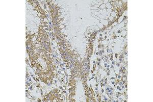 Immunohistochemistry of paraffin-embedded human stomach using HMMR antibody (ABIN5971368) at dilution of 1/100 (40x lens). (HMMR Antikörper)