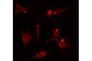 ABIN6274562 staining HepG2 cells by IF/ICC. (YWHAB Antikörper  (C-Term))