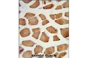 Immunohistochemistry (Paraffin-embedded Sections) (IHC (p)) image for anti-Phytanoyl-CoA 2-Hydroxylase (PHYH) (AA 59-87), (N-Term) antibody (ABIN652656)