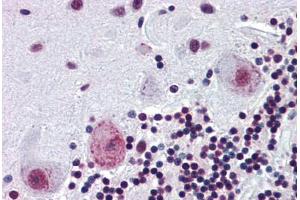 Human Brain, Cerebellum (formalin-fixed, paraffin-embedded) stained with PAX4 antibody ABIN462174 followed by biotinylated goat anti-rabbit IgG secondary antibody ABIN481713, alkaline phosphatase-streptavidin and chromogen. (PAX4 Antikörper  (AA 166-215))