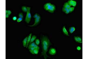 Immunofluorescent analysis of MCF-7 cells using ABIN7152188 at dilution of 1:100 and Alexa Fluor 488-congugated AffiniPure Goat Anti-Rabbit IgG(H+L) (EIF4ENIF1 Antikörper  (AA 340-630))