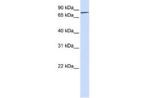 WB Suggested Anti-FERMT1 Antibody Titration:  0. (FERMT1 Antikörper  (N-Term))