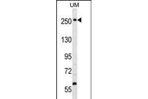 PRKWNK3 Antibody (ABIN391067 and ABIN2841218) western blot analysis in uterus tumor cell line lysates (35 μg/lane).
