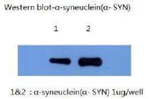 Western Blotting (WB) image for anti-Synuclein, alpha (SNCA) (AA 1-140) antibody (ABIN1105340) (SNCA Antikörper  (AA 1-140))