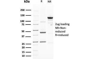 SDS-PAGE Analysis Purified MUC4 Mouse Monoclonal Antibody (MUC4/3105). (MUC4 Antikörper  (AA 1730-1864))