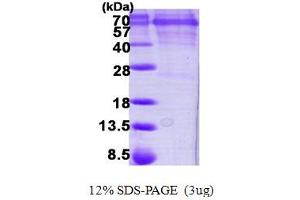 SDS-PAGE (SDS) image for Calcium/calmodulin-Dependent Protein Kinase IV (CAMK4) (AA 1-473) protein (His tag) (ABIN5780433)