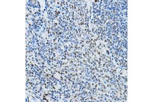 Immunohistochemistry of paraffin-embedded rat spleen using NCOR2 Rabbit pAb (ABIN6130575, ABIN6144422, ABIN6144423 and ABIN6224431) at dilution of 1:100 (40x lens). (NCOR2 Antikörper  (AA 670-900))