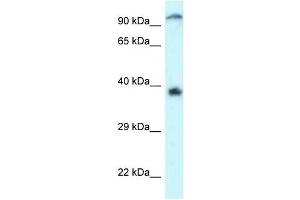Western Blot showing DOK7 antibody used at a concentration of 1 ug/ml against Jurkat Cell Lysate